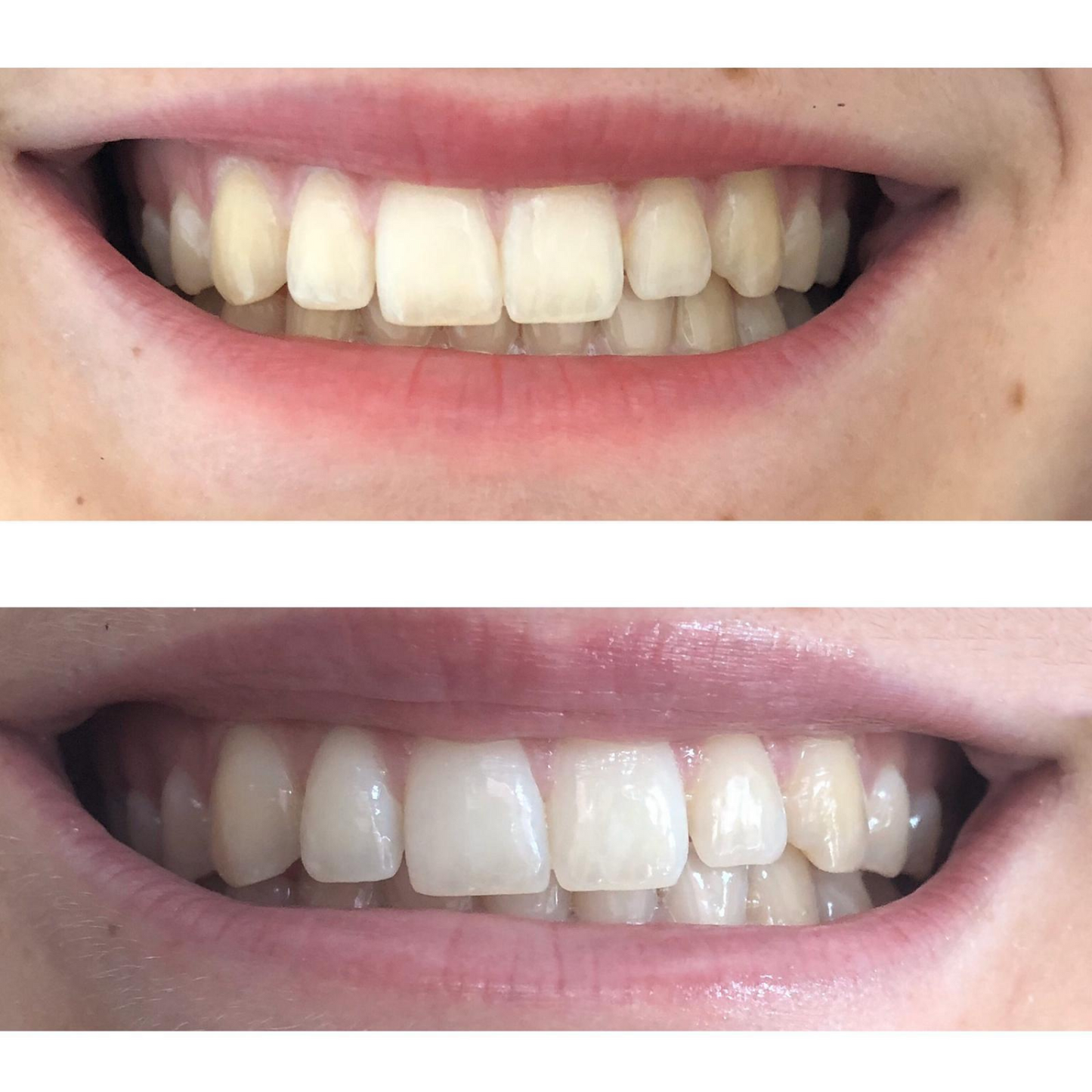 AP 24 Whitening Fluoride Toothpaste - voor wittere tanden